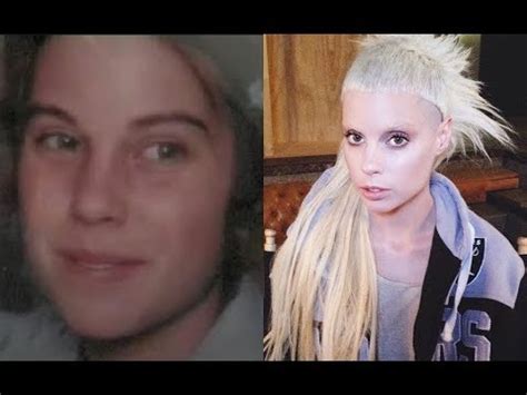 yolandi visser before after.